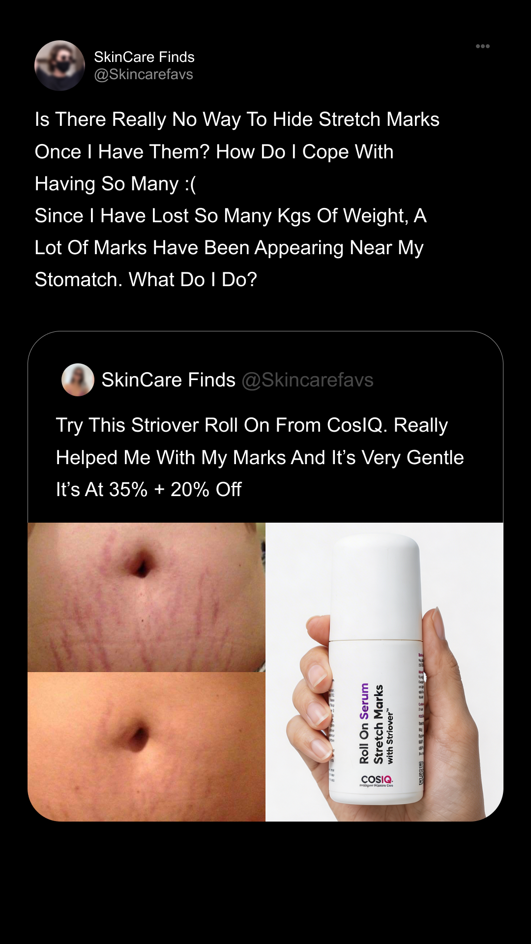COSIQ Meta ad: "Is there really no way to hide stretch marks once I have them?"