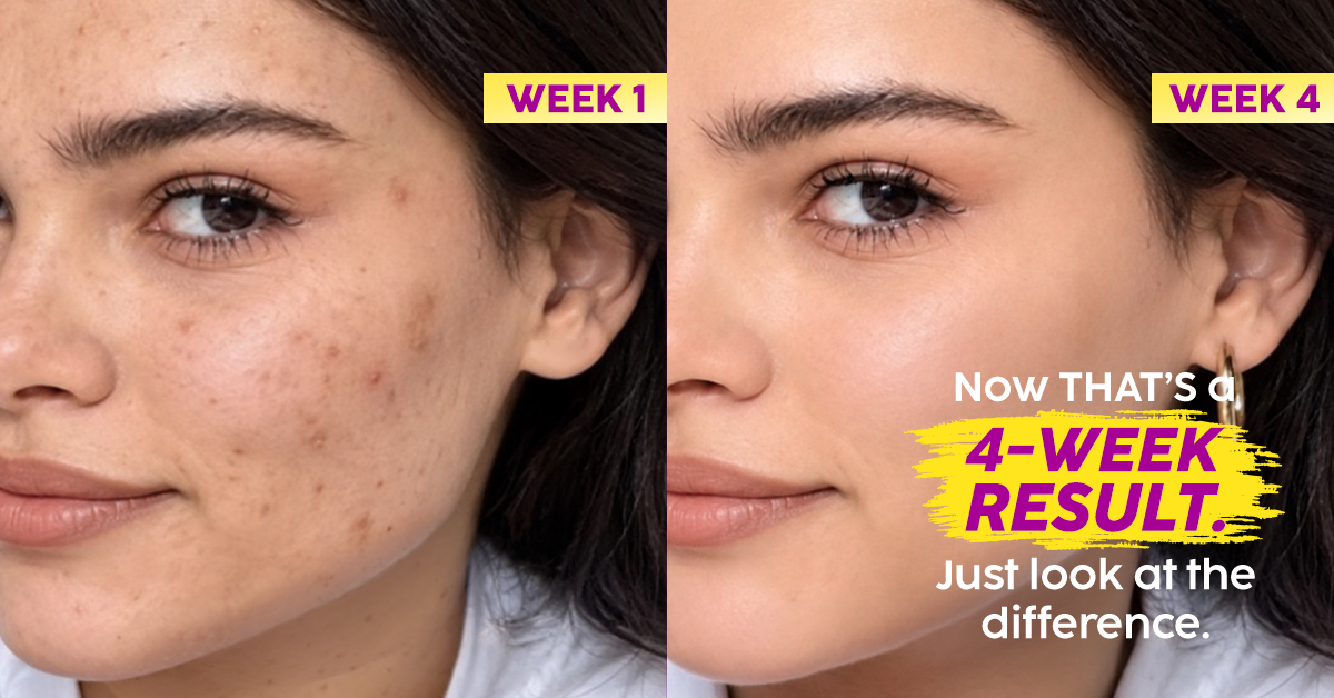 Plix Meta ad: week 1 versus week 4 results for the pineapple serum and facewash combo at INR 699